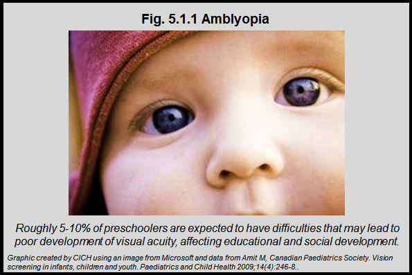 What does amblyopia mean